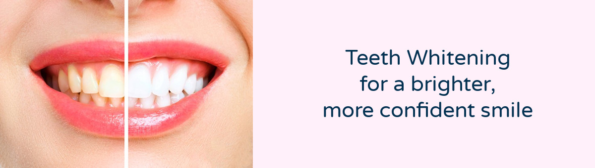 Achieve a whiter smile and gain confidence with our Teeth Whitening Service at Westbury Smiles Dental Practice Bristol